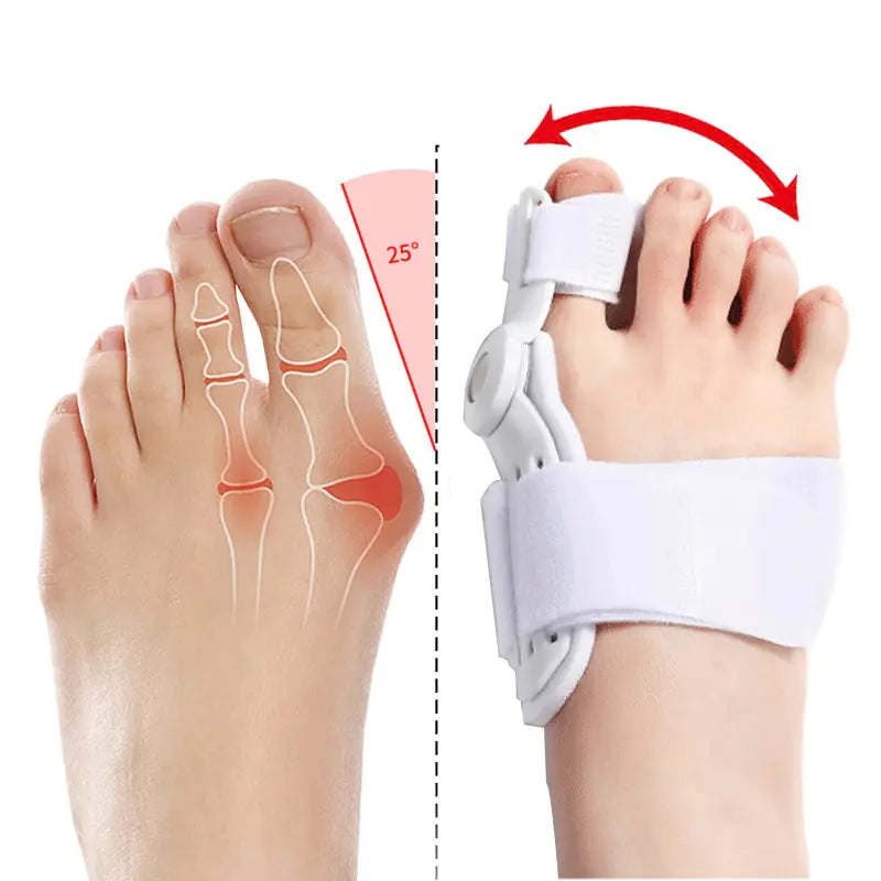 Ervaar verlichting en correctie met onze 2-delige Hallux Valgus Correctors!